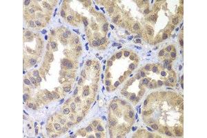 Immunohistochemistry of paraffin-embedded Human kidney using MAP2K4 Polyclonal Antibody at dilution of 1:100 (40x lens). (MAP2K4 anticorps)