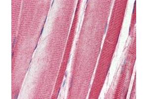 Immunohistochemical analysis of paraffin-embedded human skeletal musle tissues using DDR2 mouse mAb. (DDR2 anticorps)
