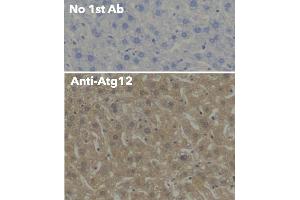 Immunohistochemistry (IHC) image for anti-Autophagy Related 12 (ATG12) (N-Term) antibody (ABIN6254241)