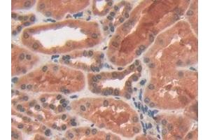 Detection of PYGL in Human Kidney Tissue using Polyclonal Antibody to Glycogen Phosphorylase, Liver (PYGL)