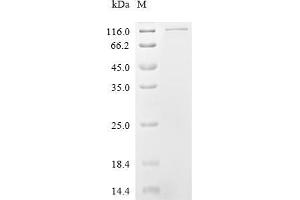 (Tris-Glycine gel) Discontinuous SDS-PAGE (reduced) with 5 % enrichment gel and 15 % separation gel.