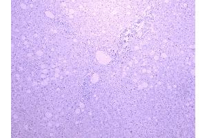 ABIN870680 Negative Control showing staining of paraffin embedded Human Liver, with no primary antibody.