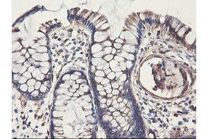 Image no. 2 for anti-phosphofructokinase, Platelet (PFKP) antibody (ABIN1500164)