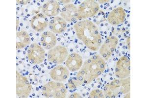 Immunohistochemistry of paraffin-embedded Mouse kidney using FGF13 Polyclonal Antibody at dilution of 1:100 (40x lens). (FGF13 anticorps)