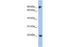 WB Suggested Anti-CDH1 Antibody Titration:  0. (E-cadherin anticorps  (Middle Region))