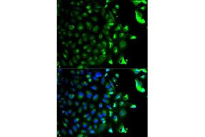 Immunofluorescence analysis of HeLa cell using RAB5A antibody. (RAB5 anticorps  (AA 1-215))