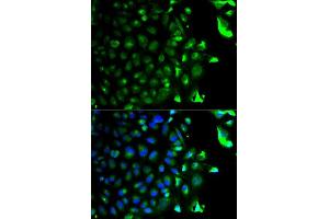 Immunofluorescence analysis of HeLa cell using RAB5A antibody. (RAB5 anticorps  (AA 1-215))