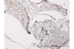 Immunoperoxidase of monoclonal antibody to CGGBP1 on formalin-fixed paraffin-embedded human testis.