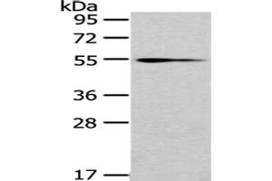Gel: 8 % SDS-PAGE,Lysate: 40 μg,Primary antibody: ABIN7192987(UGT1A4 Antibody) at dilution 1/200 dilution,Secondary antibody: Goat anti rabbit IgG at 1/8000 dilution,Exposure time: 10 minutes (UGT1A4 anticorps)