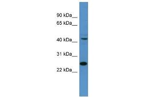 WB Suggested Anti-Tfdp1 Antibody Titration:  0. (DP1 anticorps  (N-Term))