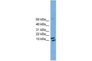 WB Suggested Anti-PPIH  Antibody Titration: 0. (PPIH anticorps  (Middle Region))