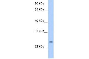 PQLC1 antibody used at 0. (PQLC1 anticorps  (Middle Region))