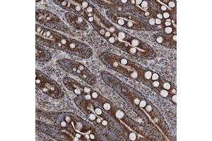 Immunohistochemical staining of human duodenum with UCN3 polyclonal antibody  shows strong granular cytoplasmic positivity in glandular cells at 1:200-1:500 dilution. (UCN3 anticorps)