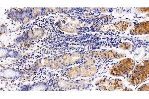 Detection of CXCR4 in Human Stomach Tissue using Polyclonal Antibody to Chemokine C-X-C-Motif Receptor 4 (CXCR4) (CXCR4 anticorps  (AA 262-352))