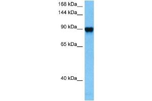 Host:  Mouse  Target Name:  GRM6  Sample Tissue:  Mouse Kidney  Antibody Dilution:  1ug/ml (Metabotropic Glutamate Receptor 6 anticorps  (C-Term))