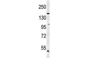 Western blot analysis of KDR antibody and mouse lung tissue lysate. (VEGFR2/CD309 anticorps  (AA 1153-1182))
