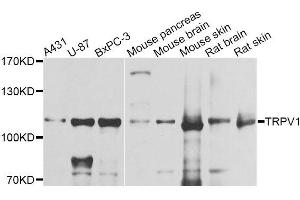 Western blot analysis of extracts of various cell lines, using TRPV1 antibody (ABIN5996282) at 1/1000 dilution. (TRPV1 anticorps)