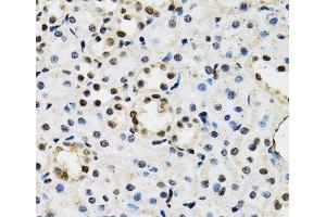 Immunohistochemistry of paraffin-embedded Mouse kidney using JADE1 Polyclonal Antibody at dilution of 1:100 (40x lens). (PHF17 anticorps)