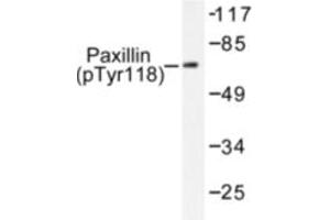 Image no. 1 for anti-Paxillin (PXN) (pTyr118) antibody (ABIN318100) (Paxillin anticorps  (pTyr118))