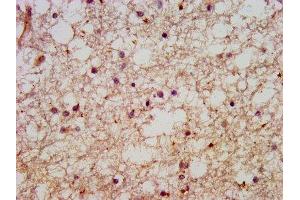 IHC image of ABIN7151025 diluted at 1:600 and staining in paraffin-embedded human brain tissue performed on a Leica BondTM system. (HACE1 anticorps  (AA 333-442))