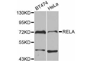 Western blot analysis of extracts of various cell lines, using RELA antibody. (NF-kB p65 anticorps)