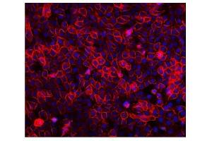 IF analysis of EGFR using anti-EGFR antibody (ABIN7601478).