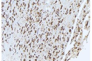 ABIN6272948 at 1/100 staining mouse brain tissue by IHC-P.