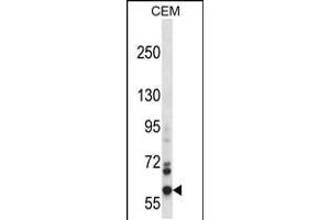 Western blot analysis in CEM cell line lysates (35ug/lane). (NOX5 anticorps  (C-Term))