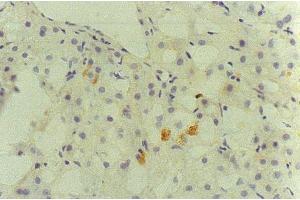 Immunohistochemistry (IHC) image for anti-Hepatitis C Virus Core Protein (HCV C) (AA 13-124), (AA 369-704) antibody (Biotin) (ABIN2451996)