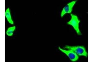 Immunofluorescence staining of HepG2 Cells with ABIN7127528 at 1:50, counter-stained with DAPI. (Recombinant Growth Hormone Receptor anticorps)