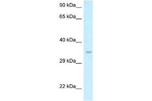 WB Suggested Anti-Six1 Antibody   Titration: 1. (SIX Homeobox 1 anticorps  (N-Term))