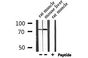 Western blot analysis of extracts from rat muscle,mouse liver, using TICAM1  Antibody.