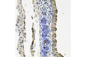 Immunohistochemistry of paraffin-embedded mouse lung using FLT1 antibody (ABIN4903685) at dilution of 1:100 (40x lens). (FLT1 anticorps)