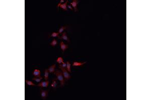 ABIN6266509 staining MCF-7 cells by IF/ICC. (Claudin 3 anticorps  (C-Term))