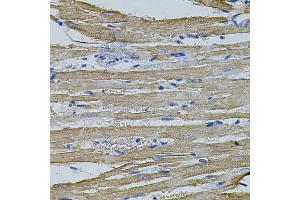 Immunohistochemistry of paraffin-embedded rat heart using EIF1AY antibody (ABIN1875833) at dilution of 1:100 (40x lens). (EIF1AY anticorps)