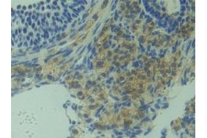 Detection of HMGCS in Mouse Ovary Tissue using Polyclonal Antibody to Hydroxymethylglutaryl Coenzyme A Synthase (HMGCS)