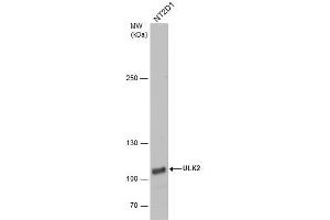 WB Image ULK2 antibody [C2C3], C-term detects ULK2 protein by western blot analysis.