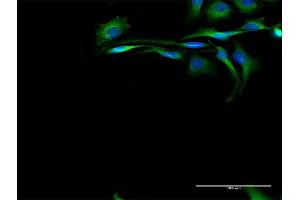 Immunofluorescence of purified MaxPab antibody to CAPN2 on HeLa cell. (Calpain 2 anticorps  (AA 1-700))