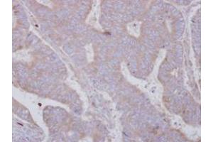 Image no. 1 for anti-SET and MYND Domain Containing 3 (SMYD3) (AA 21-416) antibody (ABIN1501007) (SMYD3 anticorps  (AA 21-416))