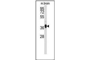 Western blot analysis of GNAO1 Antibody (C-term) Cat. (G Protein alpha 0 (AA 299-328), (C-Term) anticorps)