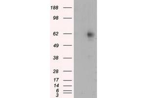 Western Blotting (WB) image for anti-Resistance To Inhibitors of Cholinesterase 8 Homolog A (C. Elegans) (RIC8A) antibody (ABIN1500704) (RIC8A anticorps)