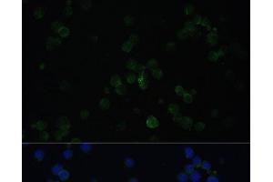 Immunofluorescence analysis of Jurkat cells using CD3D Polyclonal Antibody at dilution of 1:100. (CD3D anticorps)