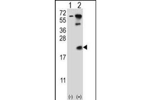 Western blot analysis of UBE2B (arrow) using rabbit polyclonal UBE2B Antibody  (ABIN388848 and ABIN2839152). (UBE2B anticorps  (C-Term))