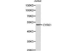 Western blot analysis of Jurkat cell lysate using CYR61 antibody. (CYR61 anticorps)
