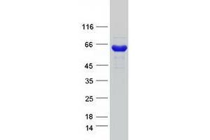 Validation with Western Blot