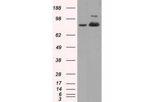 Western Blotting (WB) image for anti-Aconitase 2, Mitochondrial (ACO2) antibody (ABIN1496411) (ACO2 anticorps)