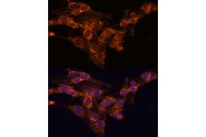 Immunofluorescence analysis of C6 cells using TMED2 antibody (ABIN7270943) at dilution of 1:100. (TMED2 anticorps  (AA 60-170))