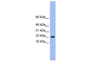 WB Suggested Anti-NXT1 Antibody Titration: 0. (NXT1 anticorps  (N-Term))