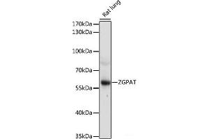 Western blot analysis of extracts of Rat lung using ZGPAT Polyclonal Antibody at dilution of 1:1000. (ZGPAT anticorps)