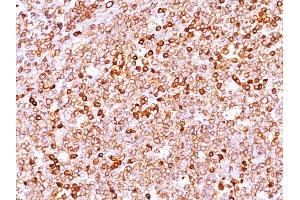 Formalin-fixed, paraffin-embedded human Tonsil stained with CD79a Mouse Monoclonal Antibody (JCB117 + HM47/A9). (CD79a anticorps  (AA 202-216))
